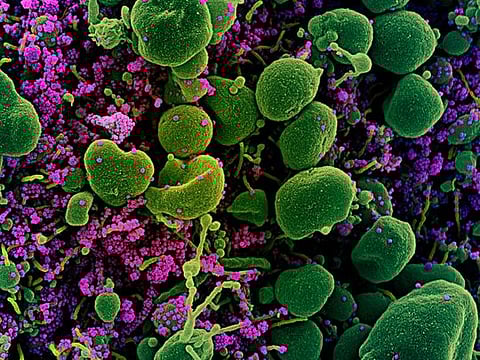 Photos: What COVID-19 looks like under a microscope