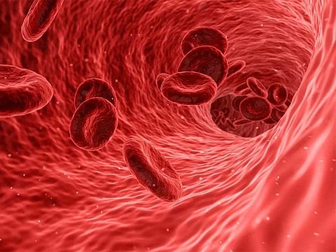  The washing of platelets removes the plasma and proteins from blood products. Picture for illustrative purposes only.