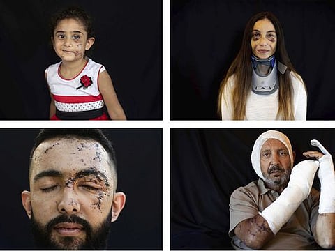 In Pictures: Scars from Beirut blast capture moment of horror