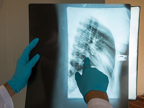  Representational image.