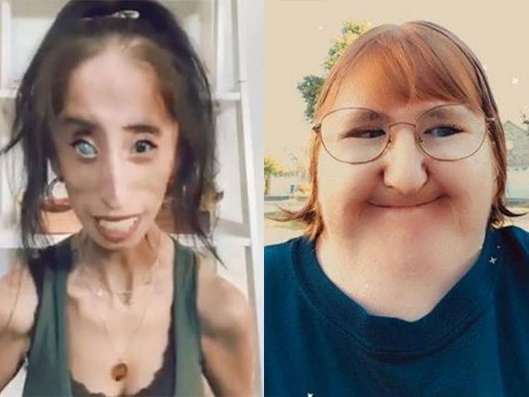 Disability advocates, Lisa Velasquez and Melissa Blake called for an end to the #NewTeacherPrank on TikTok