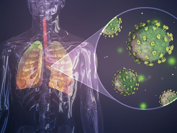 covid-19 infected lungs