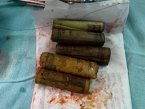 The banknotes extracted from the patient's stomach.