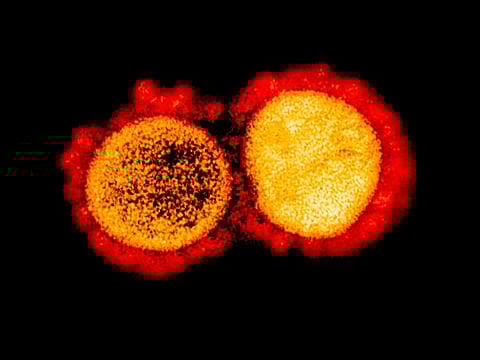 A transmission electron micrograph of SARS-CoV-2 virus particles, isolated from a patient, captured and colour-enhanced at the National Institute of Allergy and Infectious Diseases' Integrated Research Facility in Fort Detrick, Maryland, US.