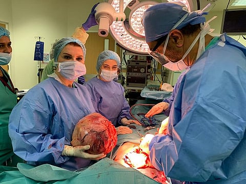 A 6kg tumour was removed from the uterus of a woman by a team of doctors at University Hospital Sharjah.