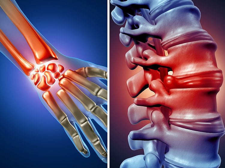 Dubai Health Authority arthritis 