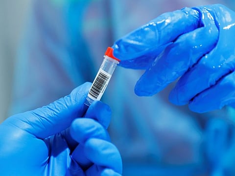 PCR test sample