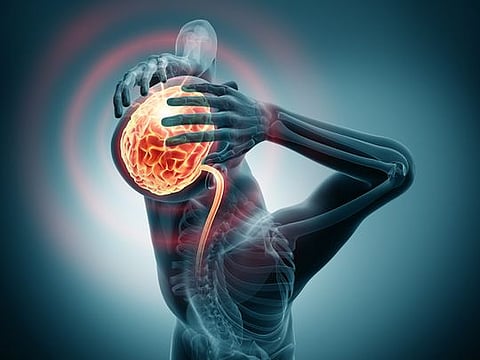 iStock