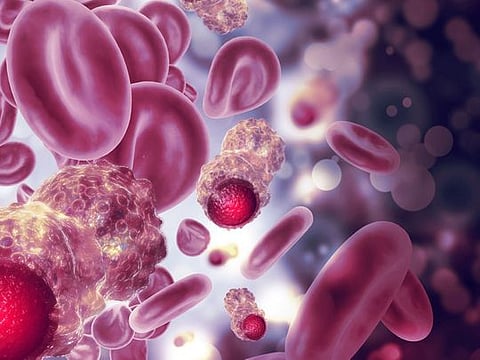 Al Zahra Hospital’s Cancer Center offers hope 