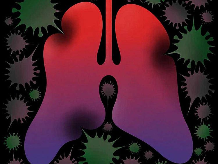 OPN-Lung-Cancer