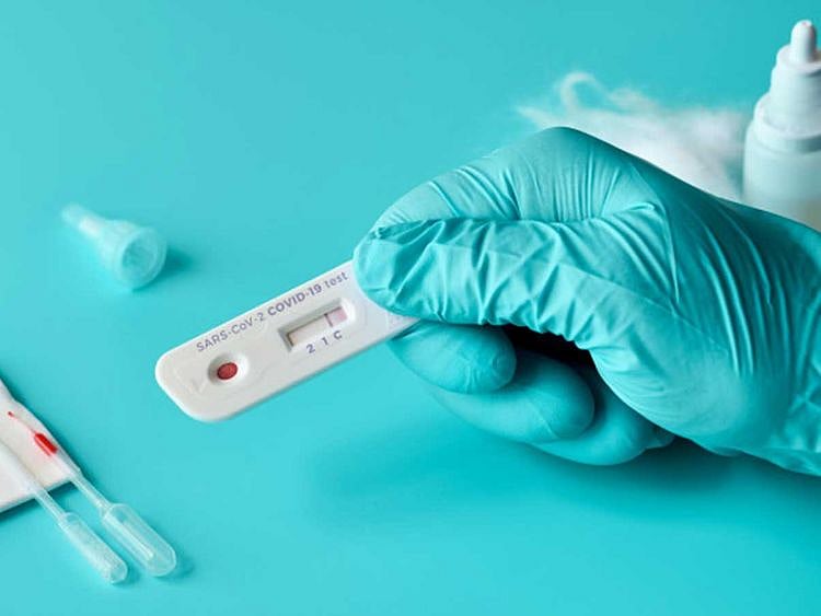 Coronavirus antigen testing