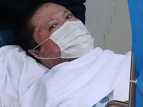 Shinji Aoba, who is suspected of the Kyoto Animation studio arson attack, looks up as he is transported on a stretcher to the Fushimi police station in Kyoto