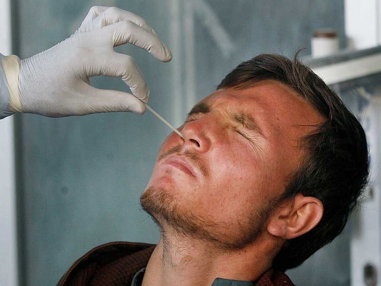 Nasal swab sample pakistan