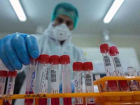 HMPV, a common respiratory virus, primarily affects children, the elderly, and those with weakened immune systems.