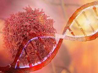 US researchers decode origins of ovarian cancer
