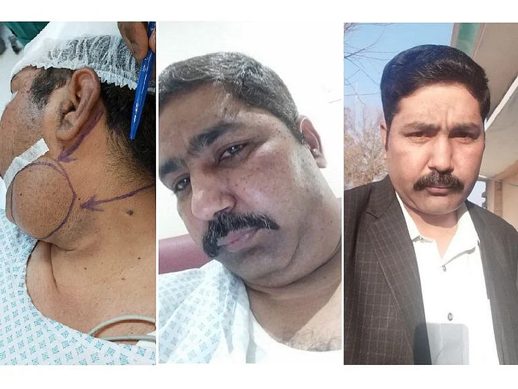 Mohammed Imran surgery