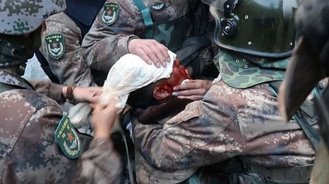 This video frame grab taken from footage recorded in mid-June 2020 and released by China Central Television (CCTV) on February 20, 2021 shows a wounded Chinese soldier receiving medical attention from his comrades following clashes between Chinese and Indian troops at an area in the Line of Actual Control (LAC) in the Galwan Valley, in the Karakoram Mountains in the Himalayas. 