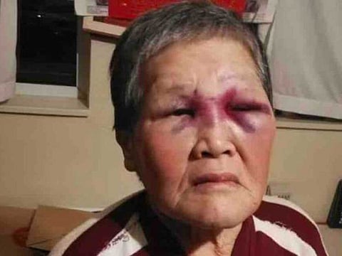 75-year-old Xiao Zhen Xie beat back a White man who punched her in San Francisco on Wednesday. Police arrested Steven Jenkins, 39, on Thursday and said he was also responsible for another unprovoked assault of an elderly Asian person that day. He is now charged with two counts of assault and elder abuse.