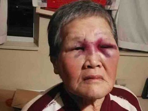 75-year-old Xiao Zhen Xie beat back a White man who punched her in San Francisco on Wednesday.