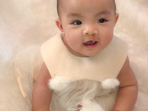 Antheia after the surgery to rectify her cleft lip -- an opening in the upper lip.