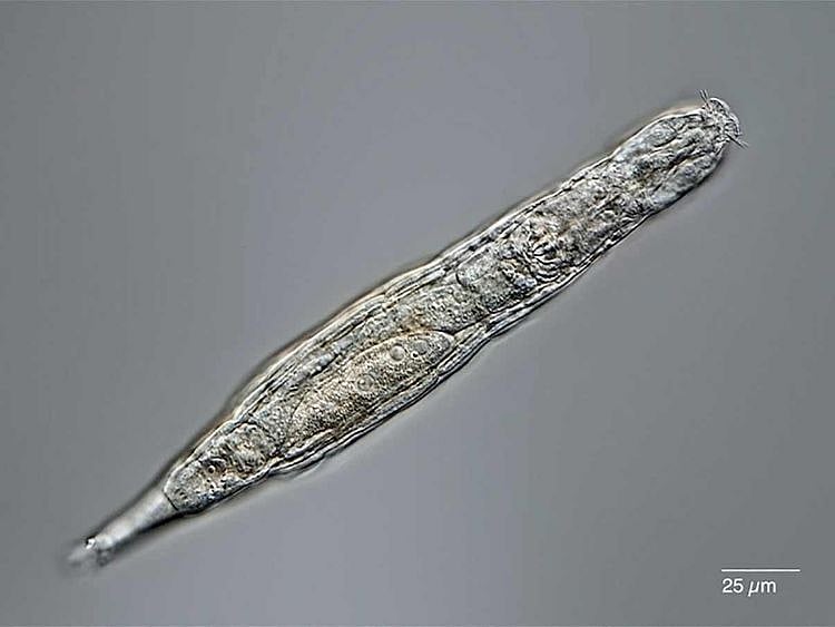 delloid rotifer