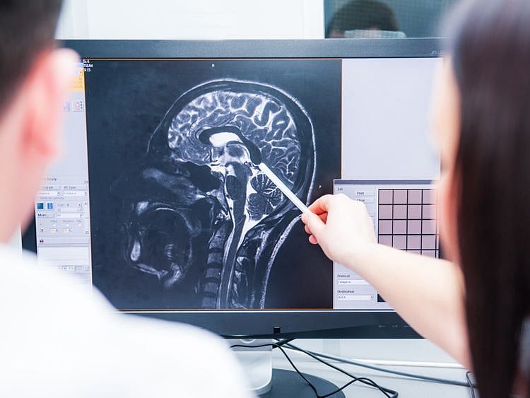 shutterstock_brain injury-1624455540151
