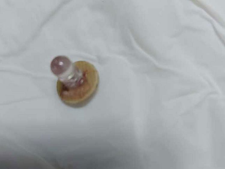 The boy’s family said that the child had swallowed the bulb while playing with his lantern, resulting in severe pains and breathing difficulties.