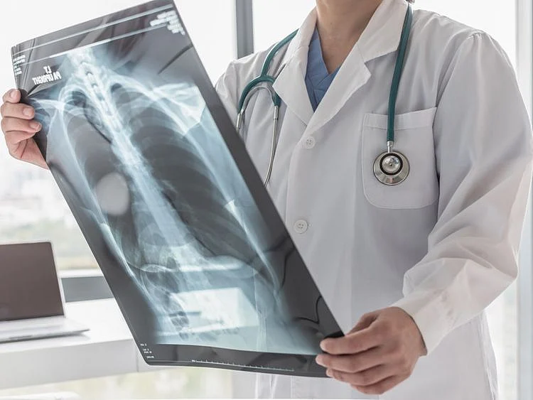 shutterstock_lung Pulmonary Fibrosis-1632374828947