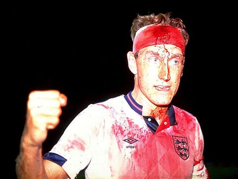 Terry Butcher famously wounded his head playing for England against Sweden in 1989 leaving him covered in blood. He says he wants heading phased out of the game to prevent injuries and dementia to players.