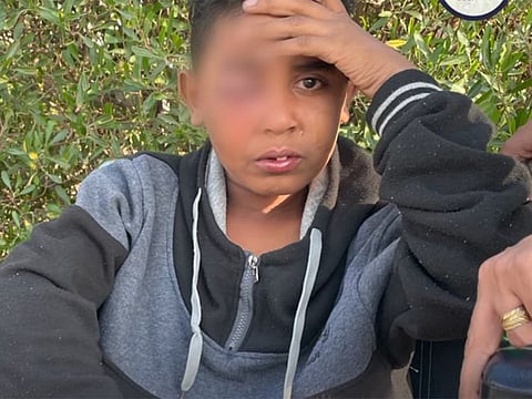  The orphaned boy is said to have gone out to buy indomie noodles and on the way back home, he happened to walk past a violent fight on the street. Suddenly, a group of people attacked him and gouged out his right eye.