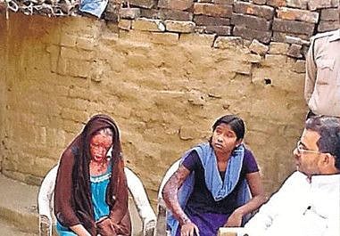 acid attack-1639226090440