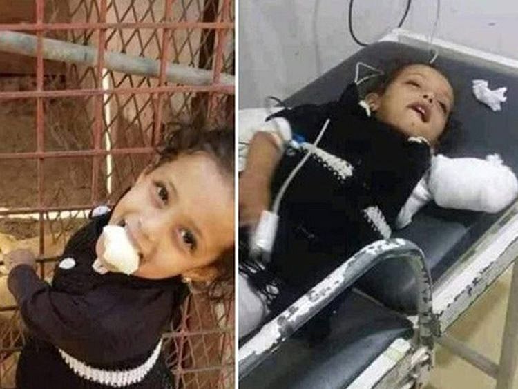 The girl at the cage (left) and later at the hospital.