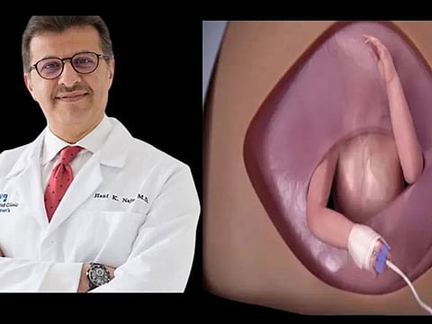 For his part, Dr. Najm tweeted: “I am happy that I was able to remove, along with the surgical team at Cleveland Clinic, a cancerous tumour from the heart of the foetus in his mother’s womb and return the foetus to the womb, to complete the pregnancy until birth,” he said.