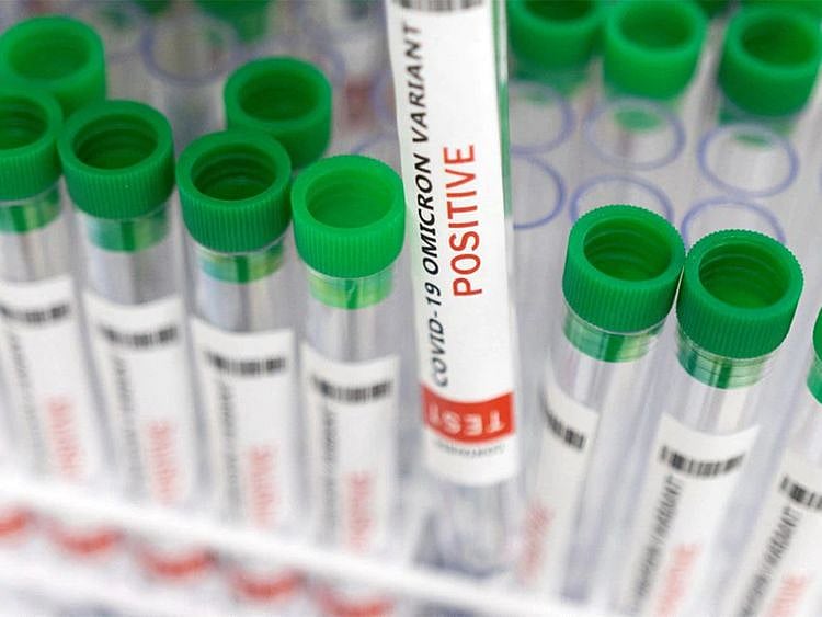 COVID-19 Omicron variant