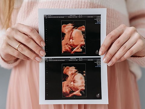 It's always nice to know what to expect when you are expecting. | Photo for illustrative purposes only.