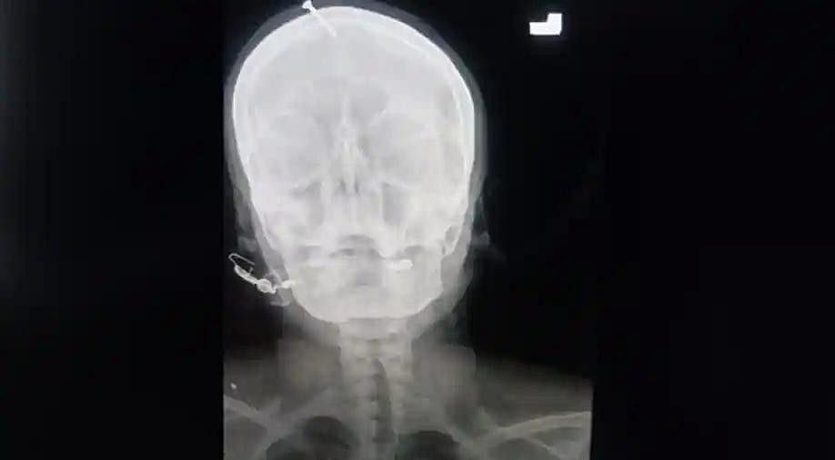 239613-nail-1644587266852