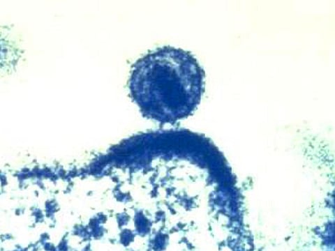 Produced by the National Institute of Allergy and Infectious Diseases (NIAID), this digitally colourised transmission electron microscopic (TEM) image, depicts a single human immunodeficiency virus (HIV), as it was budding from a human immune cell, which the virus had infected, and within which the HIV virus had been replicated. 