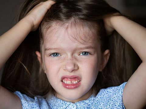  Did you know? Lice prefer clean heads.