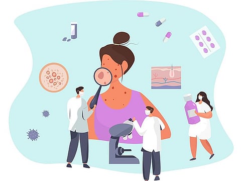 Rashes on the face and hands are a common symptom of systemic lupus erythematosus.