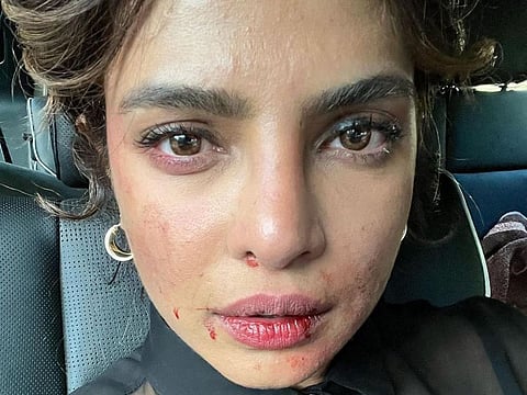 Priyanka Chopra Jonas shared an image after filming for 'Citadel'.