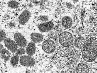 From the Editors: World on monkeypox alert