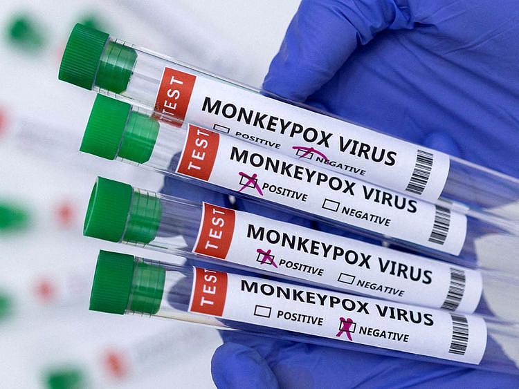 MONKEYPOX GENERIC TEST TUBE