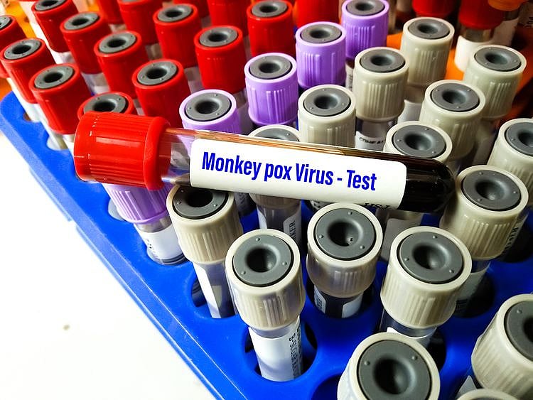Monkeypox   