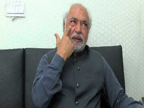 Ayaz Amir shows signs of bruises under his eye after he was assaulted while on his way from a talk show.