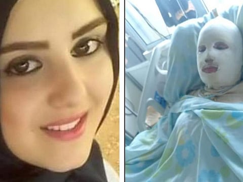 Hana Mohammad Khodur died 11 days after she was set ablaze by her husband. 