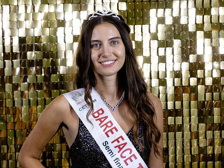 Miss England finalist Melisa Raouf has been praised for opting to not wear make-up
