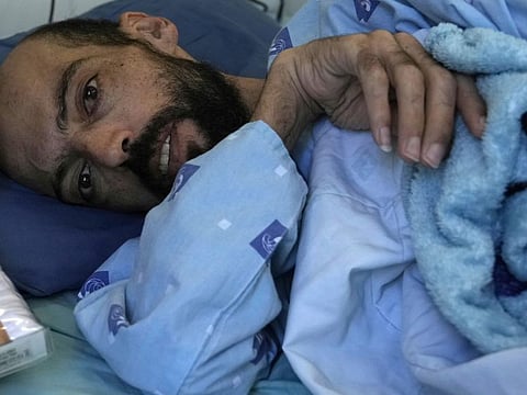 Khalil Awawdeh  at Asaf Harofeh Hospital in Be'er Ya'akov, Israel, in a August 24 photo.