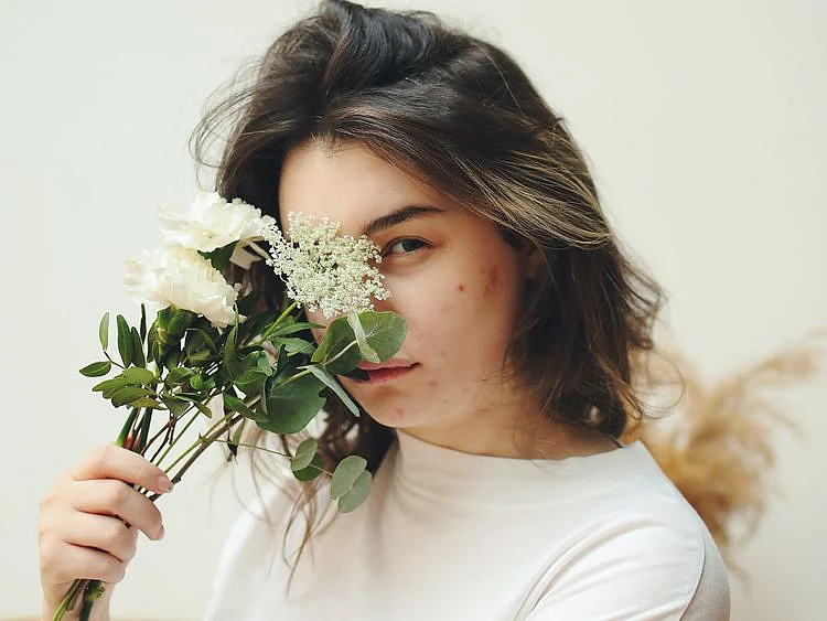 Fungal acne from Pexels.com