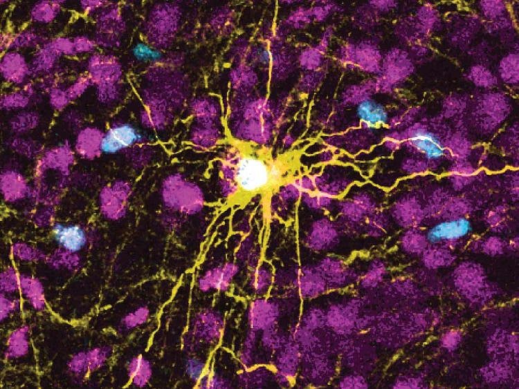 human astrocyte cell