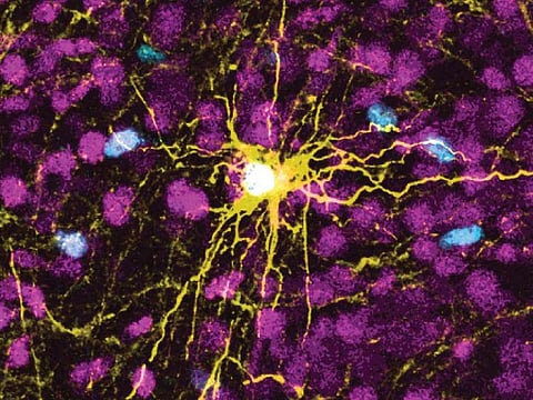 This microscope image provided by Pasca Lab/Stanford Medicine shows a human astrocyte cell, center in yellow, and human glial cells (scattered in blue) inside the brain of a rat. 